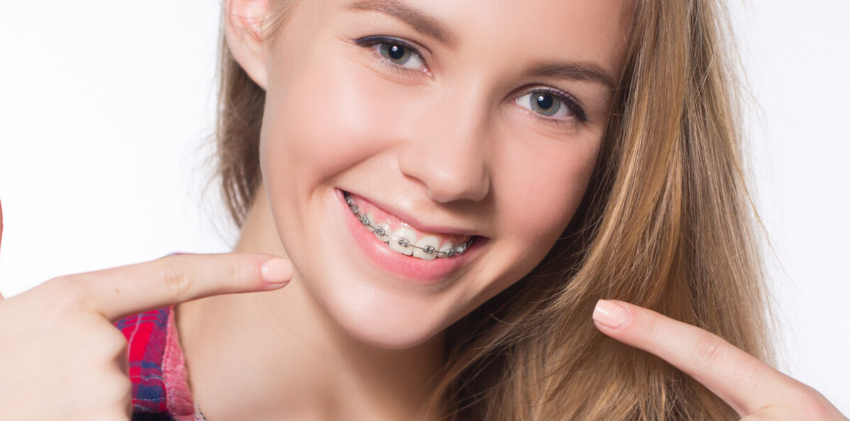 Orthodontic Emergencies Can Arise While Wearing Braces