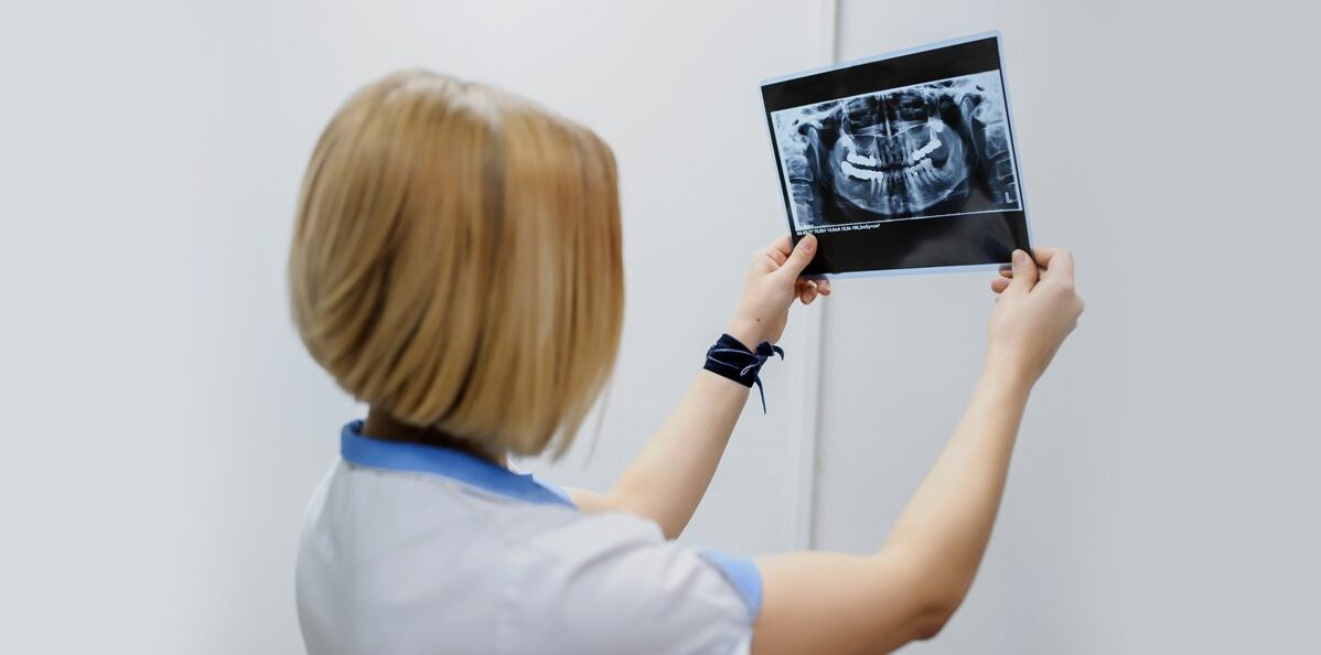 What are the Benefits of Getting Digital Dental X-Rays?