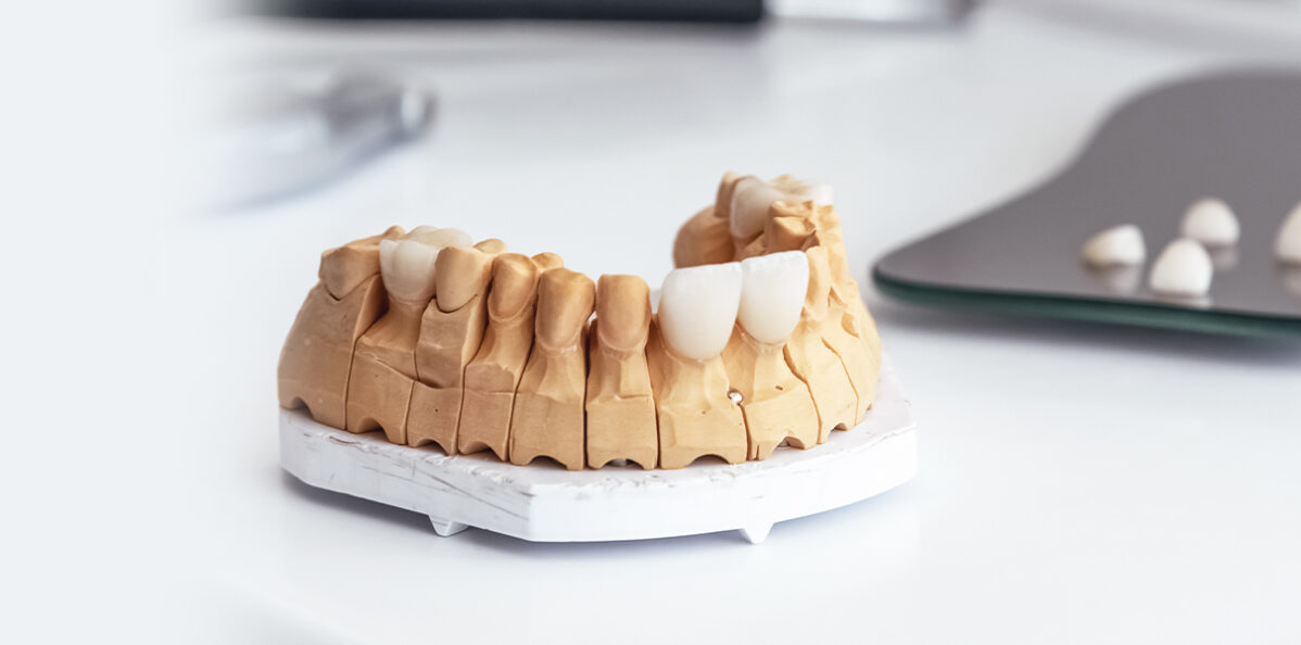 Everything You Need to Know about Lumineers