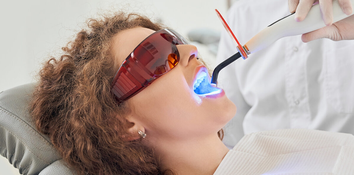Teeth Whitening for Sensitive Teeth: Facts You Need to Know | Dentist Pearland TX