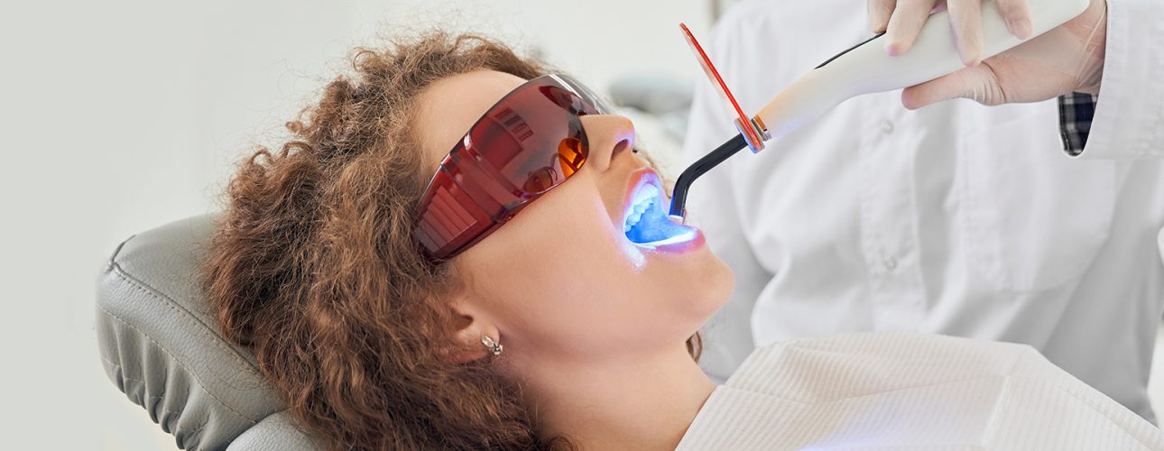 Teeth-Whitening Dentist Pearland TX