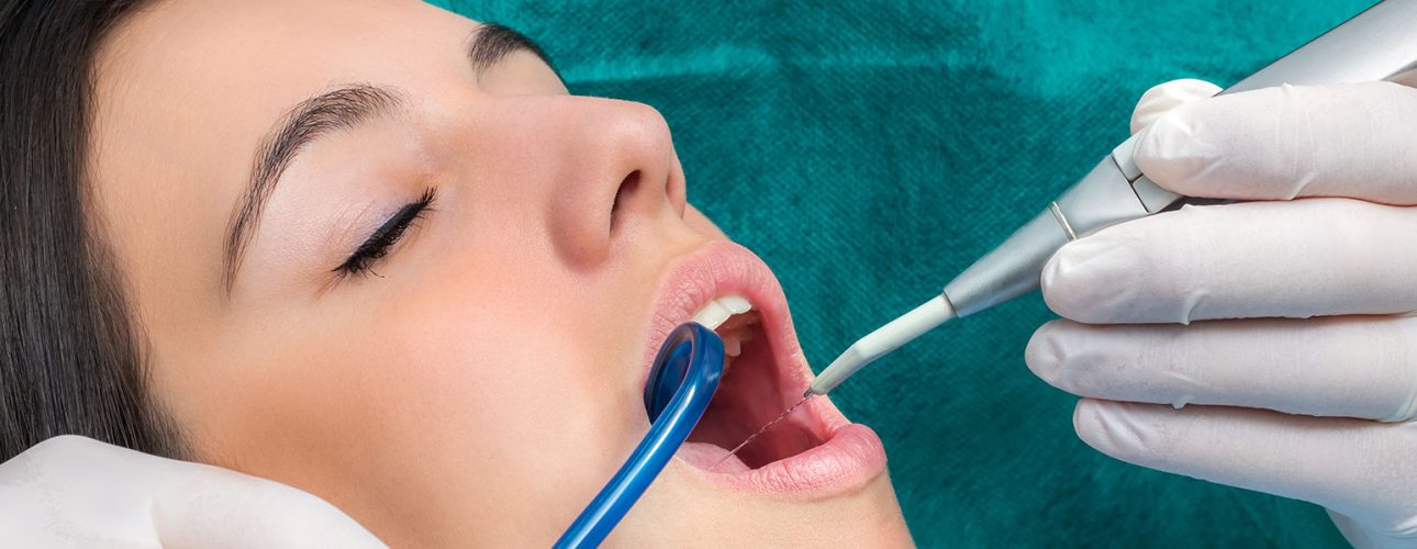 A lady having root canal